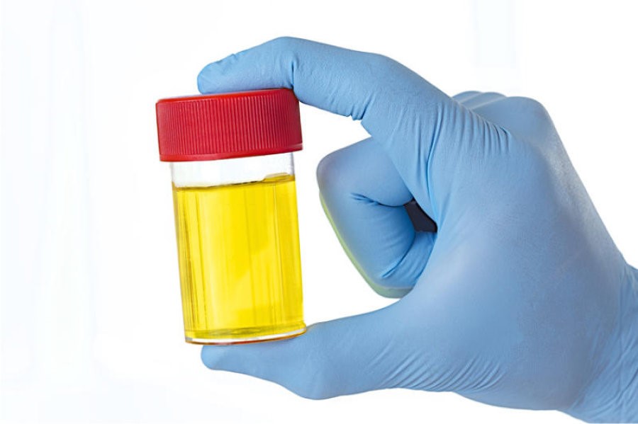 Synthetic Urine Preparation Springhill Richmond VA